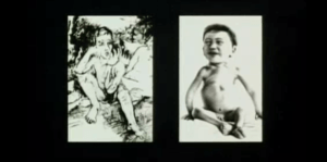 paragoni fra opere d'arte degenerata e handicap fisici